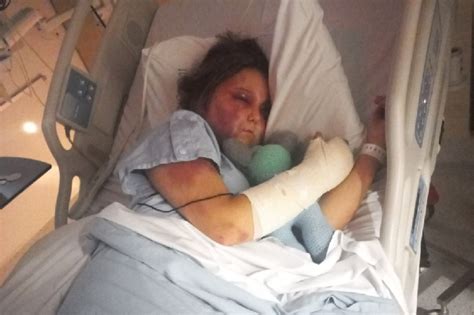 kirra story|Kirra Harts story — Her brutal attack explained